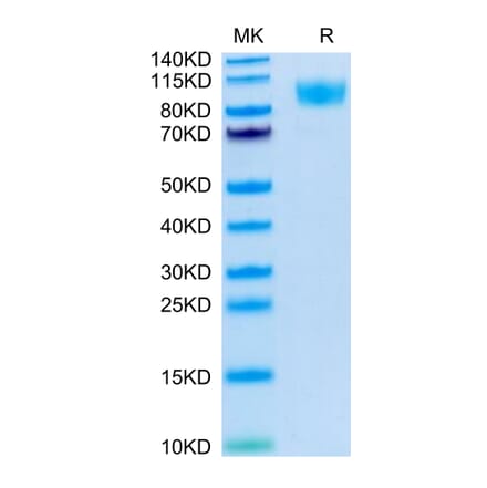 Tris-Bis PAGE - Recombinant Human CD45 Protein (Biotin) (C-terminal His and Avi Tag) (A330346) - Antibodies.com