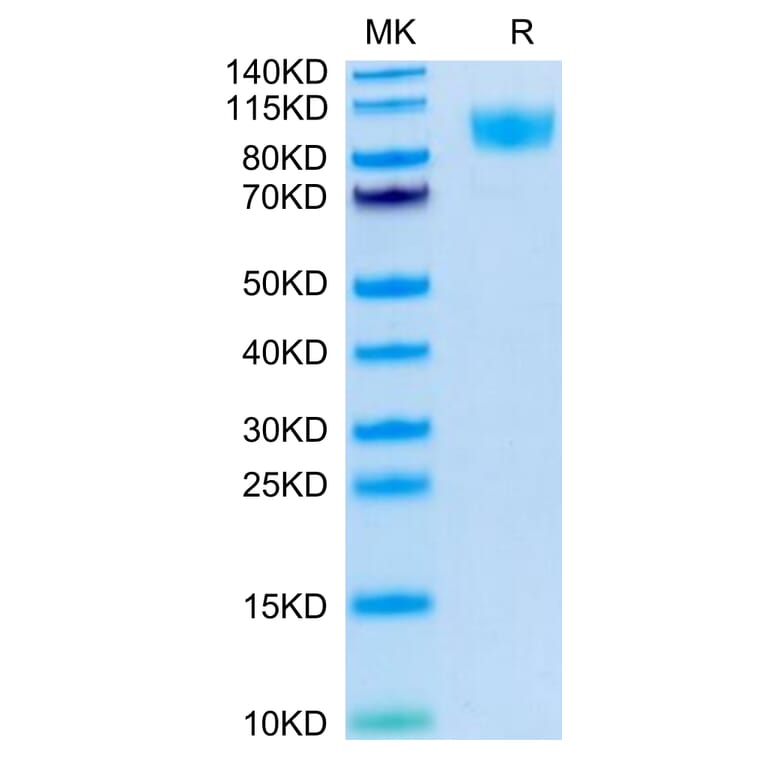 Tris-Bis PAGE - Recombinant Human CD45 Protein (Biotin) (C-terminal His and Avi Tag) (A330346) - Antibodies.com