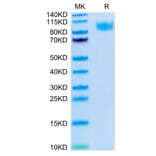 Tris-Bis PAGE - Recombinant Human CD45 Protein (Biotin) (C-terminal His and Avi Tag) (A330346) - Antibodies.com
