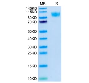 Tris-Bis PAGE - Recombinant Human CD45 Protein (C-terminal His and Avi Tag) (A330347) - Antibodies.com