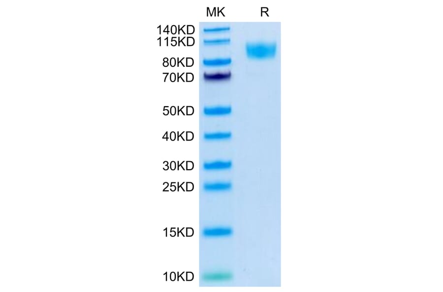 Tris-Bis PAGE - Recombinant Human CD45 Protein (C-terminal His and Avi Tag) (A330347) - Antibodies.com