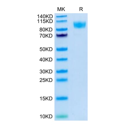 Tris-Bis PAGE - Recombinant Human CD45 Protein (C-terminal His and Avi Tag) (A330347) - Antibodies.com