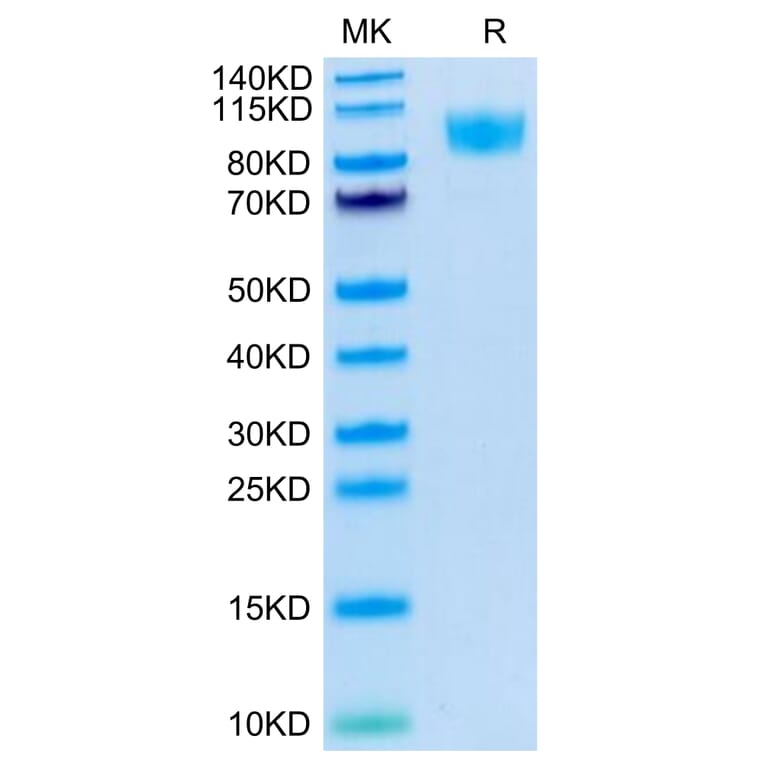 Tris-Bis PAGE - Recombinant Human CD45 Protein (C-terminal His and Avi Tag) (A330347) - Antibodies.com