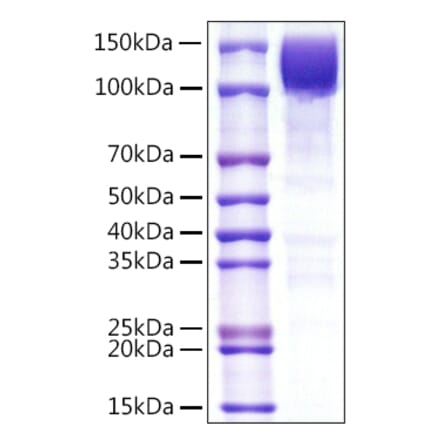 SDS-PAGE - Recombinant Human CD45 Protein (C-terminal Rabbit Fc Tag) (A330348) - Antibodies.com