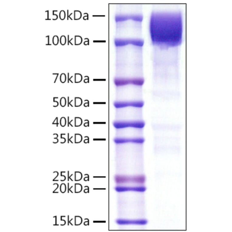SDS-PAGE - Recombinant Human CD45 Protein (C-terminal Rabbit Fc Tag) (A330348) - Antibodies.com