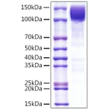SDS-PAGE - Recombinant Human CD45 Protein (C-terminal Rabbit Fc Tag) (A330348) - Antibodies.com
