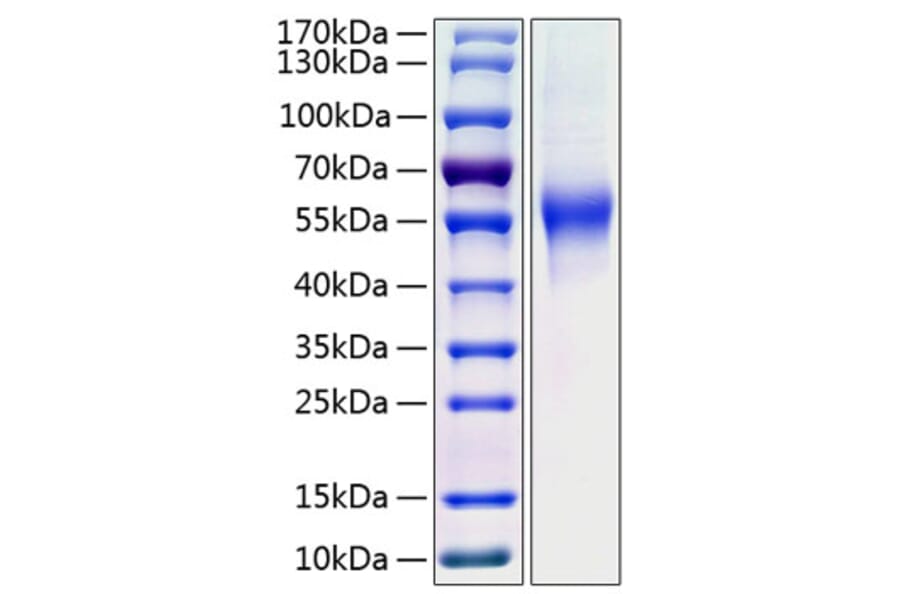 SDS-PAGE - Recombinant Human CD46 Protein (C-terminal His Tag) (A330349) - Antibodies.com