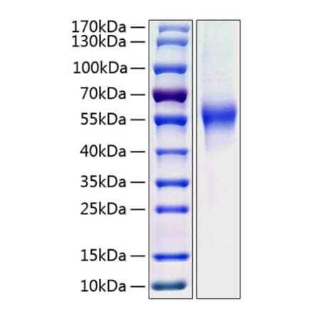 SDS-PAGE - Recombinant Human CD46 Protein (C-terminal His Tag) (A330349) - Antibodies.com