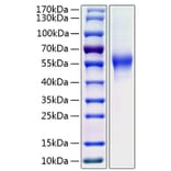 SDS-PAGE - Recombinant Human CD46 Protein (C-terminal His Tag) (A330349) - Antibodies.com