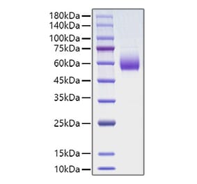 SDS-PAGE - Recombinant Rat CD47 Protein (C-terminal Human Fc Tag) (A330350) - Antibodies.com