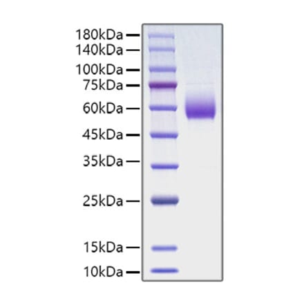 SDS-PAGE - Recombinant Rat CD47 Protein (C-terminal Human Fc Tag) (A330350) - Antibodies.com