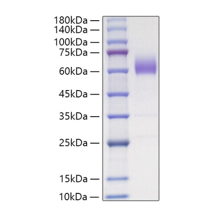 SDS-PAGE - Recombinant Mouse CD47 Protein (C-terminal Human Fc Tag) (A330351) - Antibodies.com