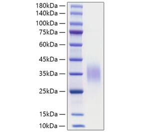 SDS-PAGE - Recombinant Mouse CD47 Protein (C-terminal His Tag) (A330352) - Antibodies.com