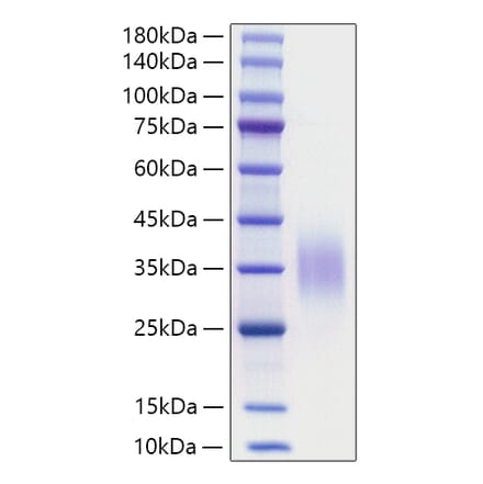SDS-PAGE - Recombinant Mouse CD47 Protein (C-terminal His Tag) (A330352) - Antibodies.com