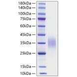 SDS-PAGE - Recombinant Mouse CD47 Protein (C-terminal His Tag) (A330352) - Antibodies.com