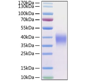 SDS-PAGE - Recombinant Human CD47 Protein (C-terminal His Tag) (A330353) - Antibodies.com