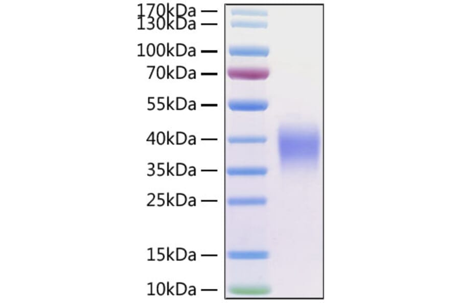 SDS-PAGE - Recombinant Human CD47 Protein (C-terminal His Tag) (A330353) - Antibodies.com