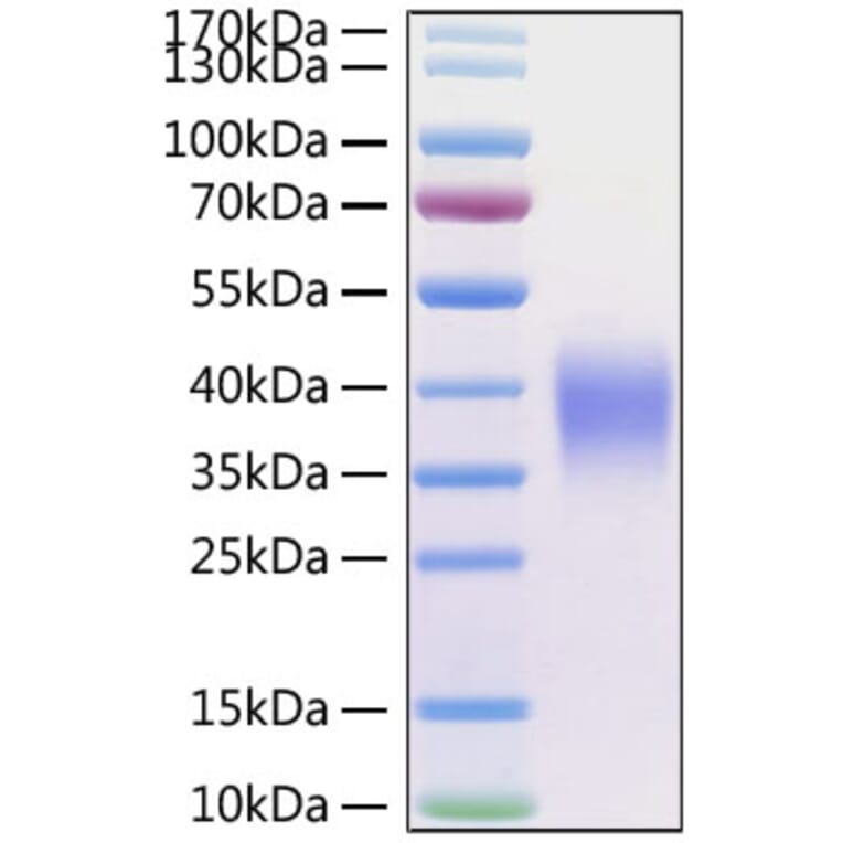 SDS-PAGE - Recombinant Human CD47 Protein (C-terminal His Tag) (A330353) - Antibodies.com
