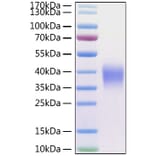 SDS-PAGE - Recombinant Human CD47 Protein (C-terminal His Tag) (A330353) - Antibodies.com