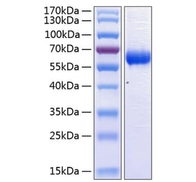 SDS-PAGE - Recombinant Human CD47 Protein (C-terminal Human Fc and His Tag) (A330354) - Antibodies.com