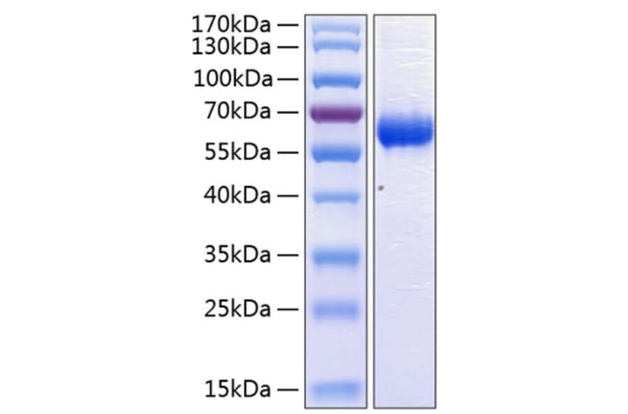 SDS-PAGE - Recombinant Human CD47 Protein (C-terminal Human Fc and His Tag) (A330354) - Antibodies.com