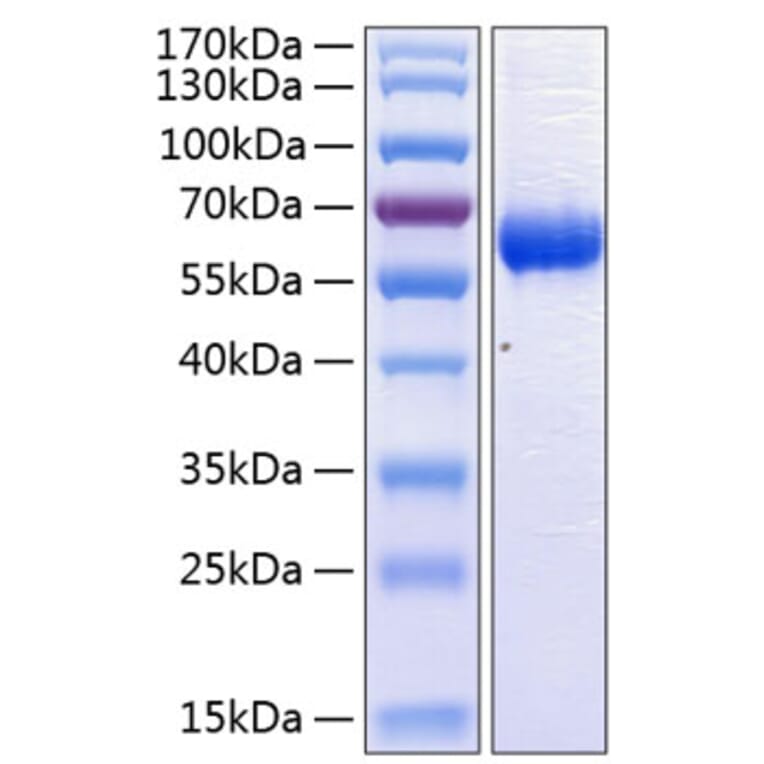 SDS-PAGE - Recombinant Human CD47 Protein (C-terminal Human Fc and His Tag) (A330354) - Antibodies.com