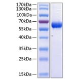 SDS-PAGE - Recombinant Human CD47 Protein (C-terminal Human Fc and His Tag) (A330354) - Antibodies.com