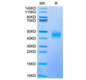 Tris-Bis PAGE - Recombinant Human CD47 Protein (Biotin) (C-terminal His and Avi Tag) (A330355) - Antibodies.com
