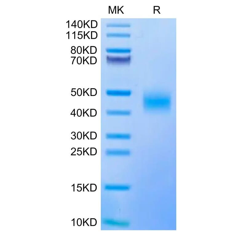 Tris-Bis PAGE - Recombinant Human CD47 Protein (Biotin) (C-terminal His and Avi Tag) (A330355) - Antibodies.com