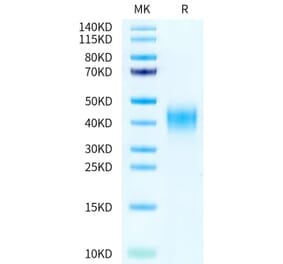 Tris-Bis PAGE - Recombinant Human CD47 Protein (A330357) - Antibodies.com