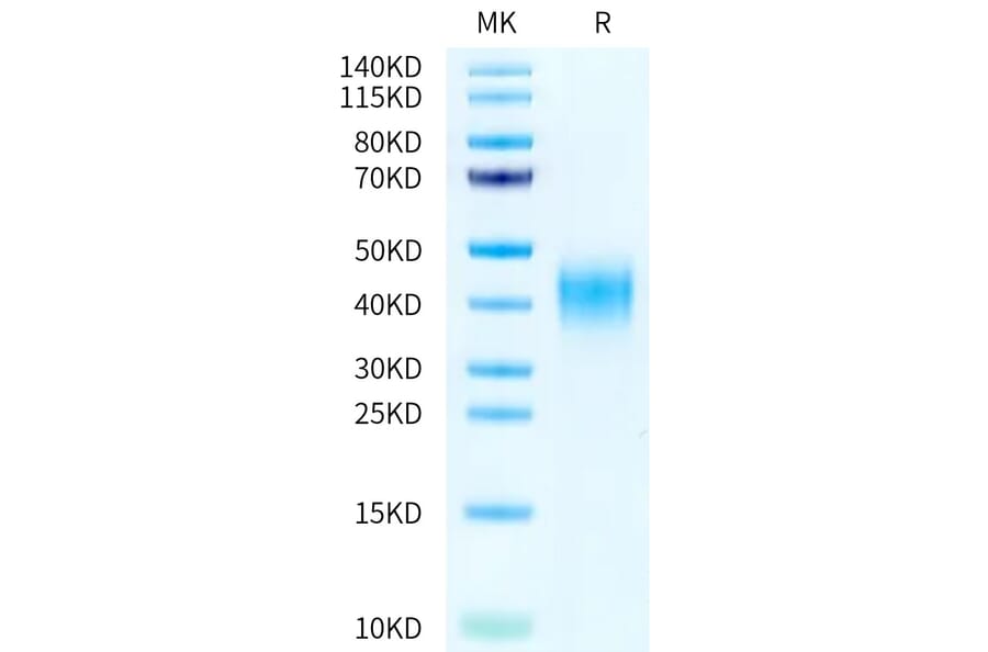 Tris-Bis PAGE - Recombinant Human CD47 Protein (A330357) - Antibodies.com