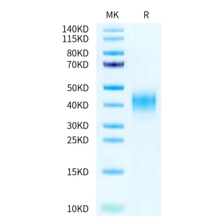 Tris-Bis PAGE - Recombinant Human CD47 Protein (A330357) - Antibodies.com