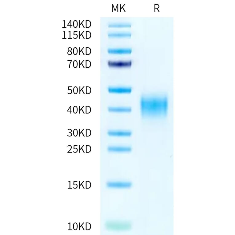 Tris-Bis PAGE - Recombinant Human CD47 Protein (A330357) - Antibodies.com