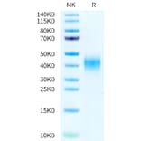 Tris-Bis PAGE - Recombinant Human CD47 Protein (A330357) - Antibodies.com