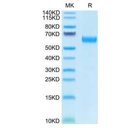 Tris-Bis PAGE - Recombinant Human CD47 Protein (C-terminal Human Fc Tag) (A330358) - Antibodies.com