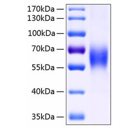 SDS-PAGE - Recombinant Human CD48 Protein (C-terminal Human Fc and His Tag) (A330359) - Antibodies.com