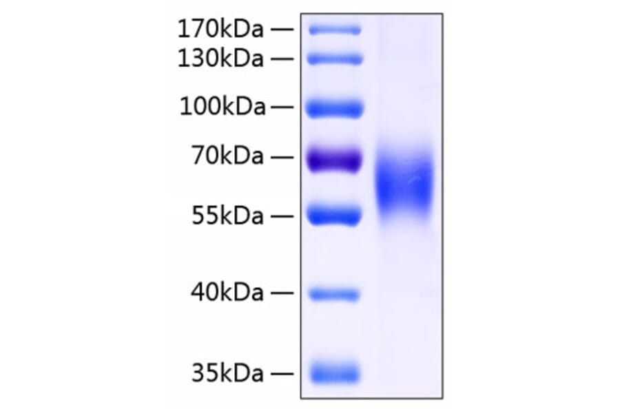 SDS-PAGE - Recombinant Human CD48 Protein (C-terminal Human Fc and His Tag) (A330359) - Antibodies.com