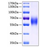 SDS-PAGE - Recombinant Human CD48 Protein (C-terminal Human Fc and His Tag) (A330359) - Antibodies.com