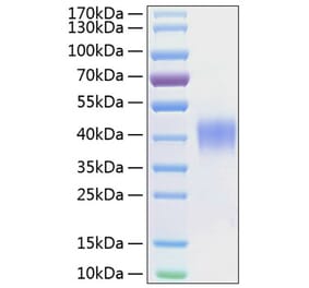 SDS-PAGE - Recombinant Human CD48 Protein (C-terminal His Tag) (A330360) - Antibodies.com