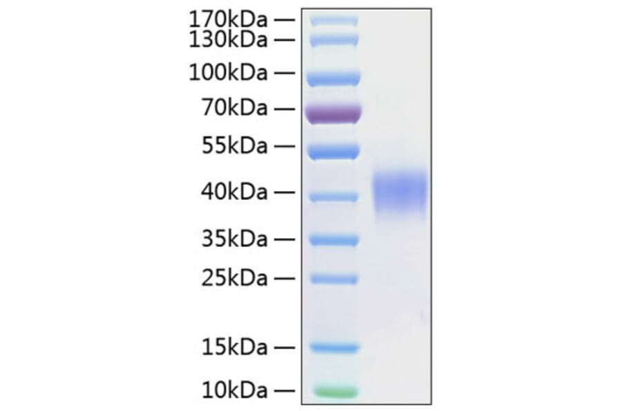 SDS-PAGE - Recombinant Human CD48 Protein (C-terminal His Tag) (A330360) - Antibodies.com