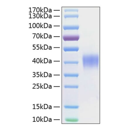 SDS-PAGE - Recombinant Human CD48 Protein (C-terminal His Tag) (A330360) - Antibodies.com