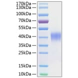 SDS-PAGE - Recombinant Human CD48 Protein (C-terminal His Tag) (A330360) - Antibodies.com