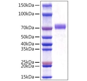 SDS-PAGE - Recombinant Mouse CD5 Protein (C-terminal His Tag) (A330361) - Antibodies.com