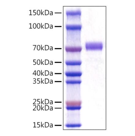 SDS-PAGE - Recombinant Mouse CD5 Protein (C-terminal His Tag) (A330361) - Antibodies.com
