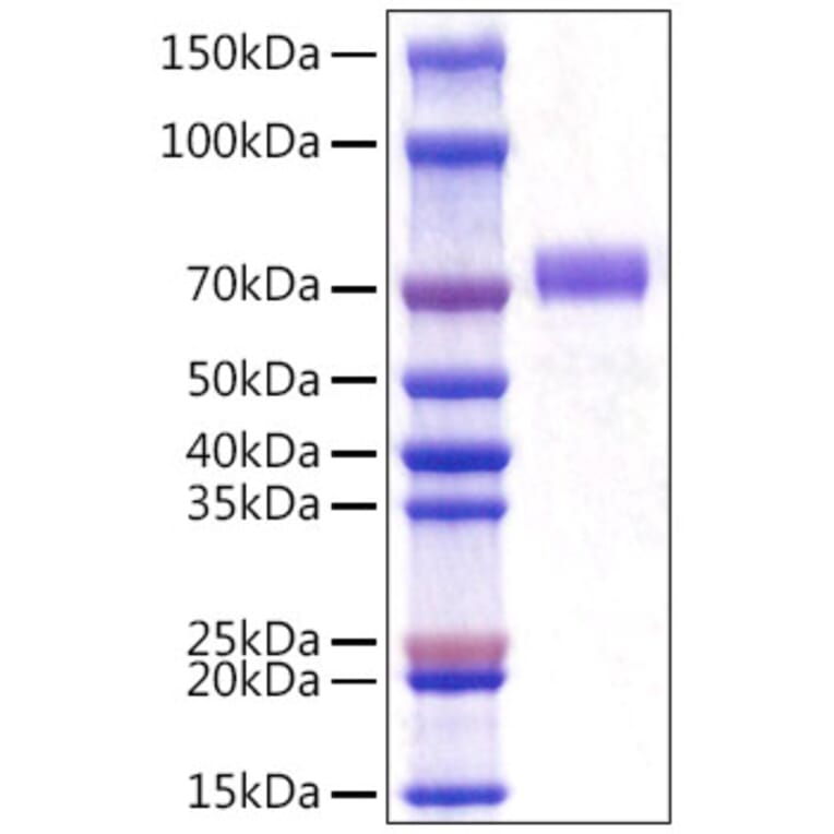 SDS-PAGE - Recombinant Mouse CD5 Protein (C-terminal His Tag) (A330361) - Antibodies.com