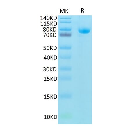 Tris-Bis PAGE - Recombinant Human CD5 Protein (Biotin) (C-terminal Human Fc and Avi Tag) (A330362) - Antibodies.com