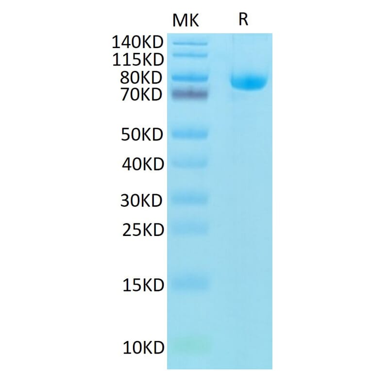 Tris-Bis PAGE - Recombinant Human CD5 Protein (Biotin) (C-terminal Human Fc and Avi Tag) (A330362) - Antibodies.com