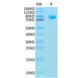 Tris-Bis PAGE - Recombinant Human CD5 Protein (Biotin) (C-terminal Human Fc and Avi Tag) (A330362) - Antibodies.com