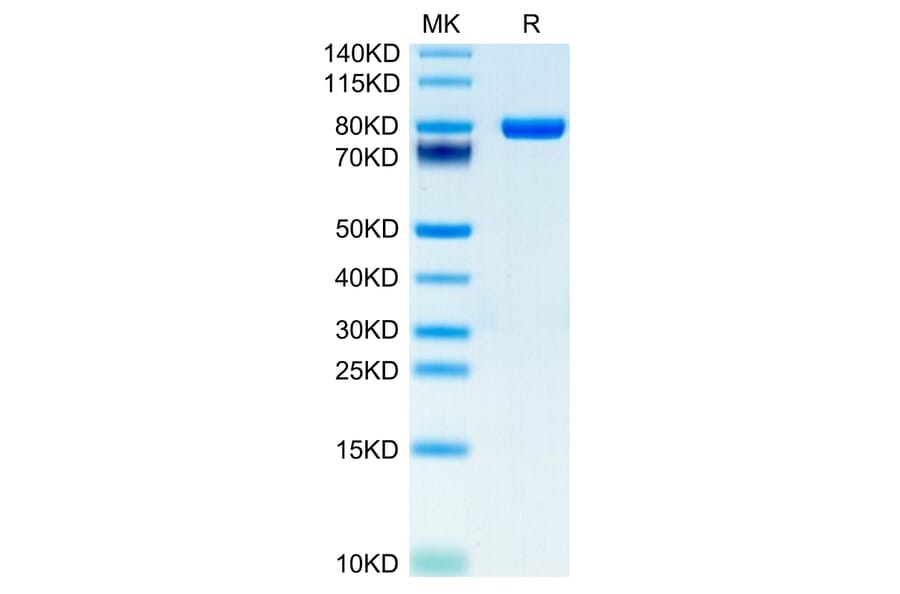 Tris-Bis PAGE - Recombinant Human CD5 Protein (C-terminal Human Fc and Avi Tag) (A330363) - Antibodies.com
