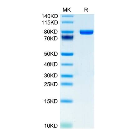 Tris-Bis PAGE - Recombinant Human CD5 Protein (C-terminal Human Fc and Avi Tag) (A330363) - Antibodies.com